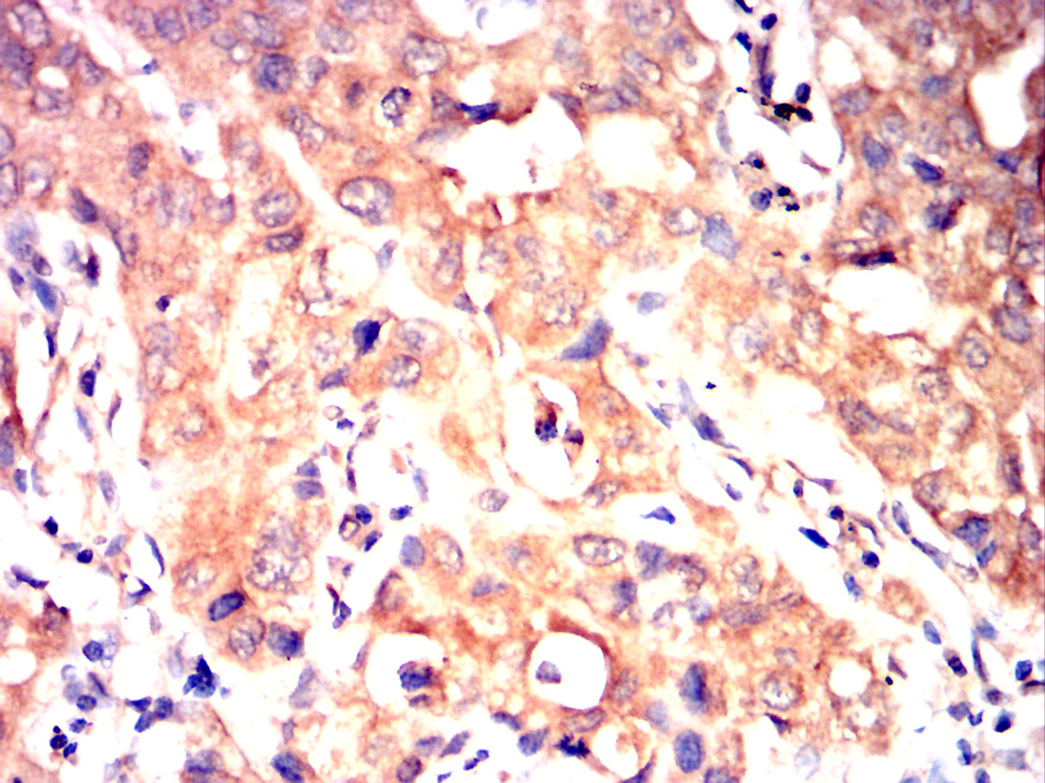 		IHC